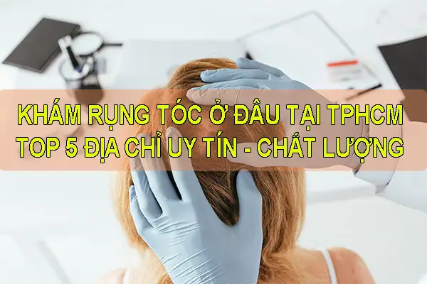 Khám Rụng Tóc Ở Đâu Tốt Nhất: Địa Chỉ Uy Tín & Kinh Nghiệm Lựa Chọn