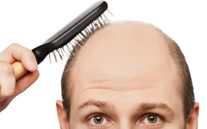 Làm Sao Để Kích Thích Mọc Tóc Ở Trán Nhanh Chóng Và Hiệu Quả? Làm Sao Để Kích Thích Mọc Tóc Ở Trán Nhanh Chóng Và Hiệu Quả?
