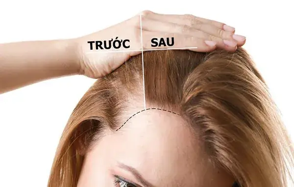 Bí Quyết Kích Thích Tóc Mau Dài Hiệu Quả Từ Thiên Nhiên & Chế Độ Dinh Dưỡng Bí Quyết Kích Thích Tóc Mau Dài Hiệu Quả Từ Thiên Nhiên & Chế Độ Dinh Dưỡng