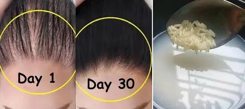 15+ Cách Kích Thích Tóc Mọc Nhanh Tự Nhiên, An Toàn Tại Nhà 15+ Cách Kích Thích Tóc Mọc Nhanh Tự Nhiên, An Toàn Tại Nhà