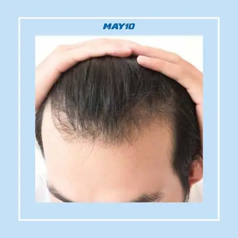 Top 10+ Kiểu Tóc Cho Người Trán Cao Tóc Mỏng Che Khuyết Điểm Hoàn Hảo Top 10+ Kiểu Tóc Cho Người Trán Cao Tóc Mỏng Che Khuyết Điểm Hoàn Hảo