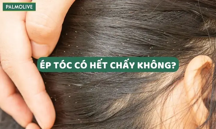 Bí Quyết Diệt Chấy Tận Gốc & An Toàn: Hướng Dẫn Chi Tiết Từ Chuyên Gia Bí Quyết Diệt Chấy Tận Gốc & An Toàn: Hướng Dẫn Chi Tiết Từ Chuyên Gia
