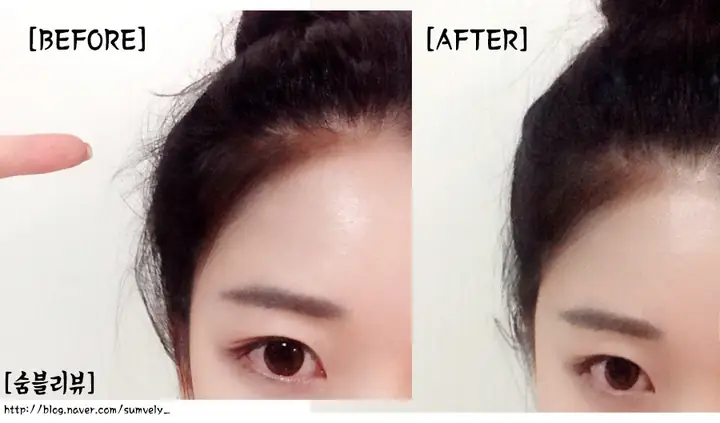 Tóc Con Mọc Lởm Chởm Trước Trán: Nguyên Nhân Và Cách Xử Lý Hiệu Quả Tóc Con Mọc Lởm Chởm Trước Trán: Nguyên Nhân Và Cách Xử Lý Hiệu Quả