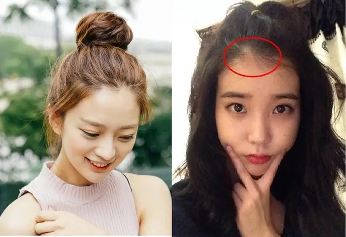 Tóc Con Mọc Lởm Chởm Trước Trán: Nguyên Nhân Và Cách Xử Lý Hiệu Quả Tóc Con Mọc Lởm Chởm Trước Trán: Nguyên Nhân Và Cách Xử Lý Hiệu Quả