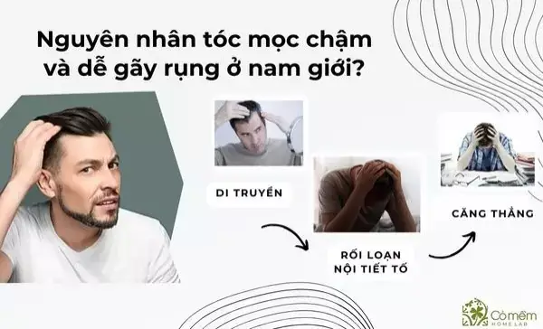 Làm Sao Để Tóc Mọc Nhanh Cho Nam Giới: Bí Quyết Kích Thích Tóc Mọc Tự Nhiên & Hiệu Quả