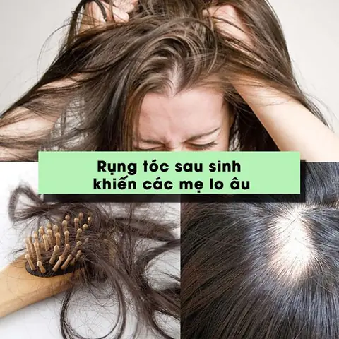 Khắc Phục Tình Trạng Rụng Tóc Sau Sinh: Bí Quyết Phục Hồi Mái Tóc Dày Mượt Cho Mẹ Bỉm Sữa