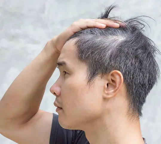 Hết Tóc Bạc Sớm: Nguyên Nhân Sâu Xa & Bí Quyết Đảo Ngược Hiệu Quả Tại Nhà
