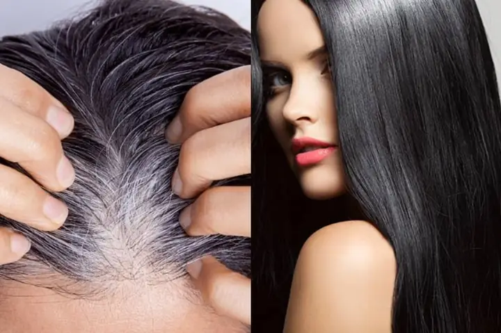 Tóc Bạc Có Thể Đen Trở Lại Không? Nguyên Nhân Và Giải Pháp Hiệu Quả