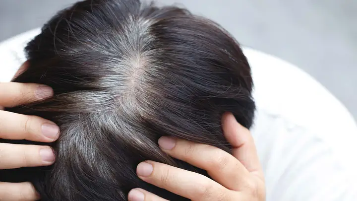 Lý Do Tóc Bạc Sớm Ở Người Trẻ: Nguyên Nhân, Dấu Hiệu Và Cách Khắc Phục Hiệu Quả