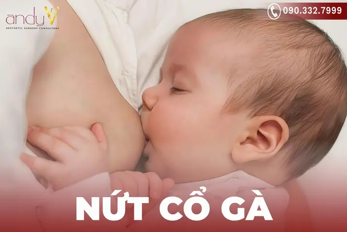 Mẹo Chữa Nứt Cổ Gà Bằng Tóc Rối: An Toàn & Hiệu Quả Cho Mẹ Bỉm