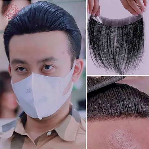 Miếng Dán Tóc Mái Hói Chữ M: Giải Pháp Tự Nhiên Cho Vấn Đề Tóc Thưa
