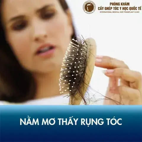 Mơ Thấy Chải Đầu Rụng Tóc: Giải Mã Điềm Báo Tình Duyên, Sự Nghiệp & Con Số May Mắn Mơ Thấy Chải Đầu Rụng Tóc: Giải Mã Điềm Báo Tình Duyên, Sự Nghiệp & Con Số May Mắn