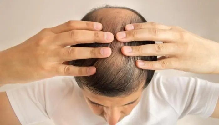 Giải Mã Giấc Mơ Vuốt Tóc Rụng: Điềm Báo Sức Khỏe, Tình Cảm Và Con Số May Mắn
