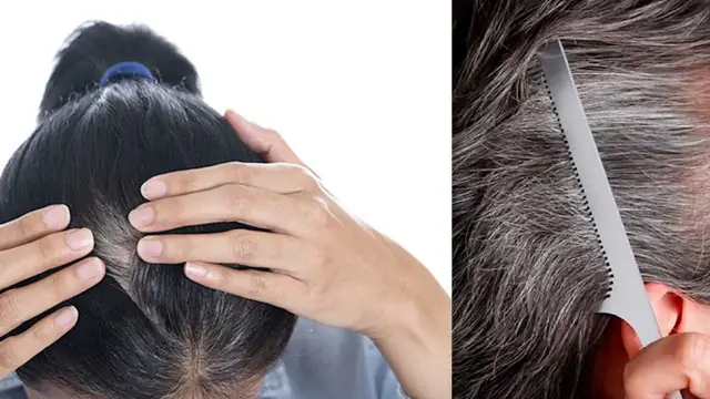 Rụng Tóc Tuổi Già: Nguyên Nhân, Dấu Hiệu & Bí Quyết Phục Hồi Hiệu Quả Rụng Tóc Tuổi Già: Nguyên Nhân, Dấu Hiệu & Bí Quyết Phục Hồi Hiệu Quả