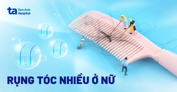 Nguyên Nhân Rụng Tóc Nhiều Ở Nữ Giới: Nhận Biết & Khắc Phục Hiệu Quả