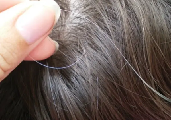 Nguyên Nhân Tóc Bạc Sớm Ở Người Trẻ: Hiểu Rõ & Ngăn Ngừa Hiệu Quả