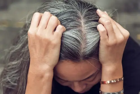Tóc Bạc Sớm: Nguyên Nhân, Cách Điều Trị Và Phòng Ngừa Hiệu Quả