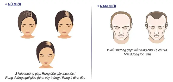 Nguyên Nhân Khiến Tóc Mọc Chậm Và Cách Kích Thích Tóc Dài Nhanh