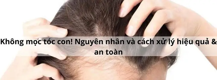 Nhà Sư Cạo Trọc: Vì Sao Tóc Không Mọc Lại Và Các Phương Pháp Triệt Lông Tóc Tự Nhiên Nhà Sư Cạo Trọc: Vì Sao Tóc Không Mọc Lại Và Các Phương Pháp Triệt Lông Tóc Tự Nhiên