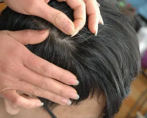 Nhổ Tóc Bạc Bằng Răng: "thú Vui" Hay Lầm Tưởng Về Sức Khỏe Tóc? Nhổ Tóc Bạc Bằng Răng: "thú Vui" Hay Lầm Tưởng Về Sức Khỏe Tóc?