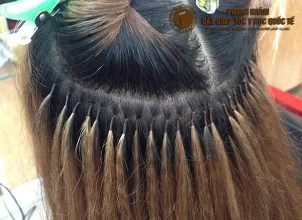 Nối Tóc Có Hại Gì Không? Cập Nhật Tác Hại Cần Biết Trước Khi Làm Đẹp Nối Tóc Có Hại Gì Không? Cập Nhật Tác Hại Cần Biết Trước Khi Làm Đẹp