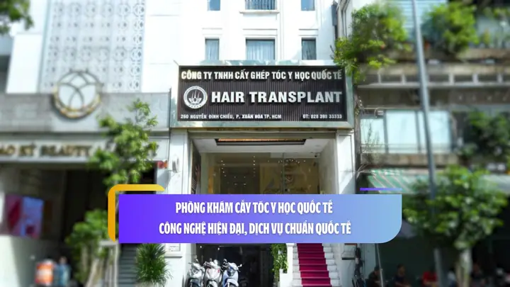 Tìm Phòng Khám Cấy Ghép Tóc Uy Tín: Hướng Dẫn Chi Tiết & Bảng Giá Cập Nhật Tìm Phòng Khám Cấy Ghép Tóc Uy Tín: Hướng Dẫn Chi Tiết & Bảng Giá Cập Nhật