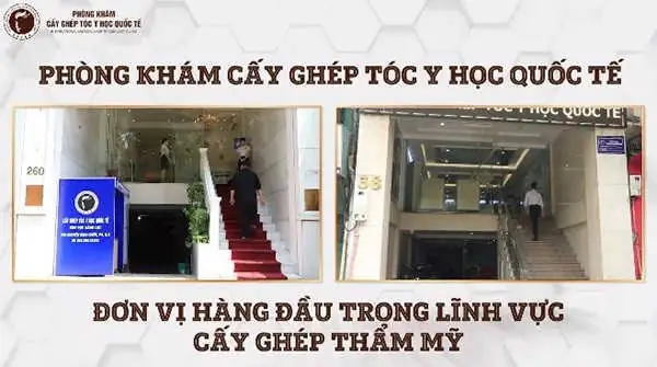Phòng Khám Cấy Ghép Tóc Y Học Quốc Tế: Lựa Chọn Tối Ưu Cho Mái Tóc Tự Tin