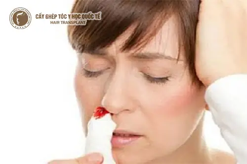 Rụng Tóc & Chảy Máu Chân Răng: Dấu Hiệu Cảnh Báo Sức Khỏe Tiềm Ẩn & Cách Khắc Phục