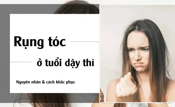 Rụng Tóc Nhiều Tuổi Dậy Thì: Nguyên Nhân & Cách Khắc Phục Hiệu Quả Cho Thanh Thiếu Niên