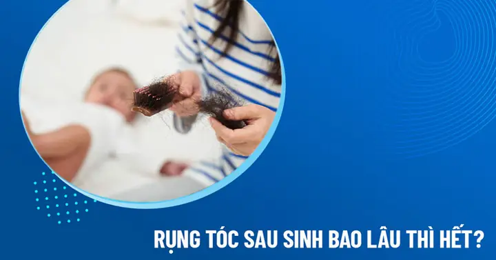 Rụng Tóc Sau Sinh Bao Lâu Thì Hết? Nguyên Nhân & Cách Khắc Phục Hiệu Quả