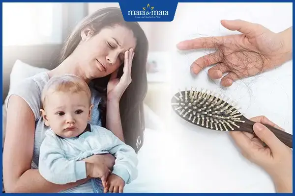 Rụng Tóc Sau Sinh Kéo Dài Bao Lâu? Nguyên Nhân & Cách Phục Hồi Tóc Toàn Diện