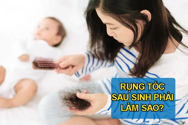 Rụng Tóc Sau Sinh: Nguyên Nhân, Cách Khắc Phục & Bí Quyết Phục Hồi Tóc Dày Mượt Cho Mẹ Bỉm