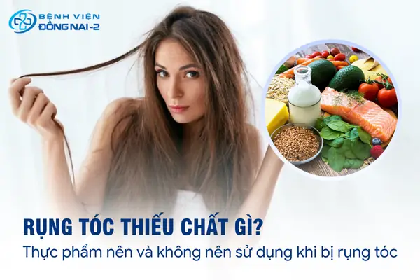 Rụng Tóc Thiếu Chất Gì? Dấu Hiệu Và Cách Bổ Sung Dưỡng Chất Tóc Chắc Khỏe