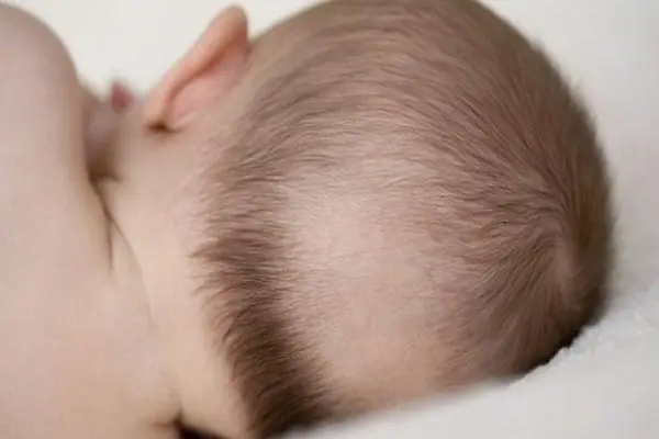 Trẻ 3 Tháng Tuổi Rụng Tóc Vành Khăn: Nguyên Nhân, Dấu Hiệu Và Cách Xử Lý An Toàn Trẻ 3 Tháng Tuổi Rụng Tóc Vành Khăn: Nguyên Nhân, Dấu Hiệu Và Cách Xử Lý An Toàn