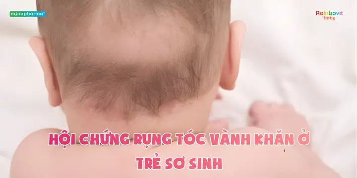 Rụng Tóc Vành Khăn Ở Trẻ: Nguyên Nhân, Dấu Hiệu Nhận Biết Và Cách Xử Lý Hiệu Quả Rụng Tóc Vành Khăn Ở Trẻ: Nguyên Nhân, Dấu Hiệu Nhận Biết Và Cách Xử Lý Hiệu Quả