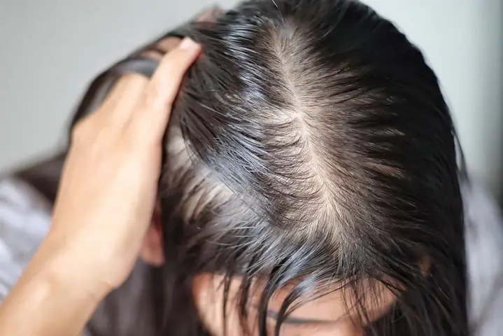 Sợi Tóc Có Đoạn Dày Đoạn Mỏng: Nguyên Nhân, Dấu Hiệu & Cách Xử Lý Hiệu Quả Sợi Tóc Có Đoạn Dày Đoạn Mỏng: Nguyên Nhân, Dấu Hiệu & Cách Xử Lý Hiệu Quả