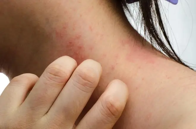Tác Hại Kinh Hoàng Của Thuốc Nhuộm Tóc: Cảnh Báo & Giải Pháp An Toàn Cho Phái Đẹp