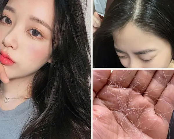 Tại Sao Suy Nghĩ Nhiều Lại Tóc Bạc Sớm? Nguyên Nhân, Khoa Học Và Giải Pháp Tại Sao Suy Nghĩ Nhiều Lại Tóc Bạc Sớm? Nguyên Nhân, Khoa Học Và Giải Pháp