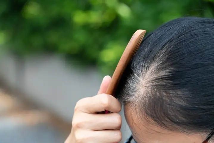 Tại Sao Tóc Bạc Sớm: Nguyên Nhân Toàn Diện Và Giải Pháp Tối Ưu