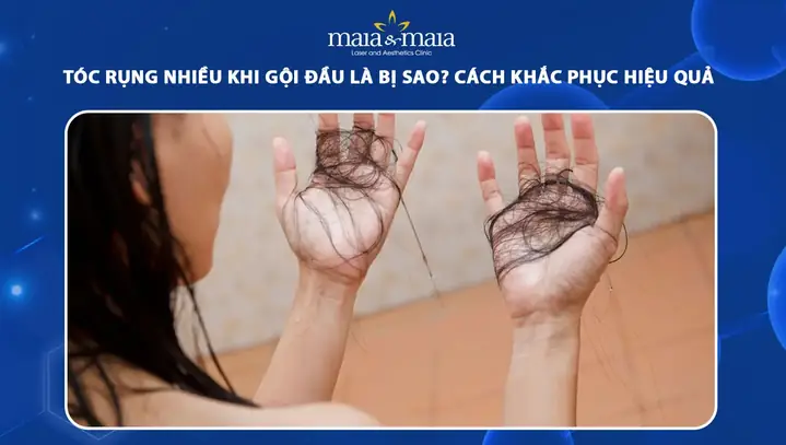 Tại Sao Tóc Rụng Nhiều Khi Gội Đầu? Nguyên Nhân & Cách Khắc Phục Hiệu Quả Tại Sao Tóc Rụng Nhiều Khi Gội Đầu? Nguyên Nhân & Cách Khắc Phục Hiệu Quả