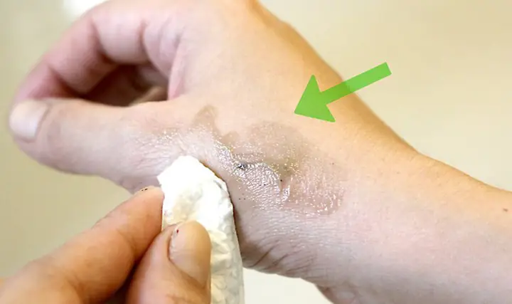 Cách Tẩy Thuốc Nhuộm Tóc Dính Trên Da Hiệu Quả & An Toàn Tại Nhà Cách Tẩy Thuốc Nhuộm Tóc Dính Trên Da Hiệu Quả & An Toàn Tại Nhà