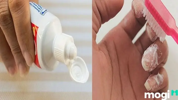 Cách Tẩy Thuốc Nhuộm Tóc Dính Trên Da Hiệu Quả & An Toàn Tại Nhà Cách Tẩy Thuốc Nhuộm Tóc Dính Trên Da Hiệu Quả & An Toàn Tại Nhà