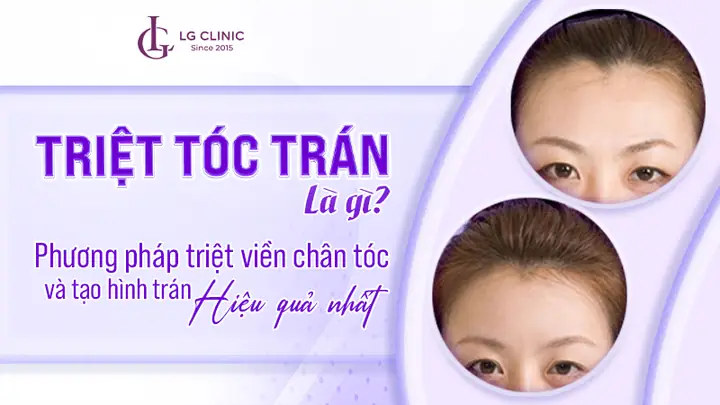Xử Lý Tóc Con Tơ Trên Trán Hiệu Quả: Bí Quyết Giữ Nếp Tự Nhiên