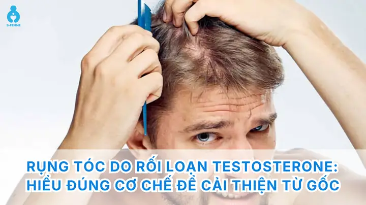 Testosterone Cao Gây Rụng Tóc: Hiểu Rõ Nguyên Nhân, Cơ Chế Và Giải Pháp Từ Gốc