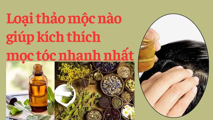 Top 10 Thảo Dược Giúp Tóc Mọc Nhanh & Dày Hiệu Quả Nhất Hiện Nay
