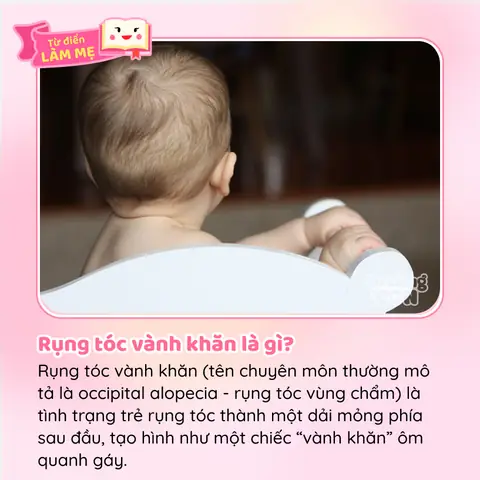 Thiếu Canxi Có Gây Rụng Tóc Không? Nguyên Nhân, Dấu Hiệu Và Cách Khắc Phục Toàn Diện Thiếu Canxi Có Gây Rụng Tóc Không? Nguyên Nhân, Dấu Hiệu Và Cách Khắc Phục Toàn Diện