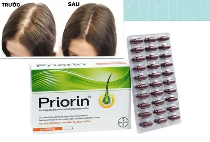 Top Thuốc Chống Rụng Tóc & Kích Thích Mọc Tóc Hiệu Quả Nhất Hiện Nay: Lựa Chọn An Toàn & Tối Ưu Top Thuốc Chống Rụng Tóc & Kích Thích Mọc Tóc Hiệu Quả Nhất Hiện Nay: Lựa Chọn An Toàn & Tối Ưu