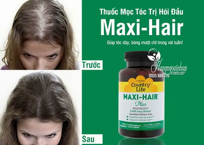 Thuốc Mọc Tóc Cho Người Hói: Top Giải Pháp Tối Ưu & Hiệu Quả Nhất Hiện Nay