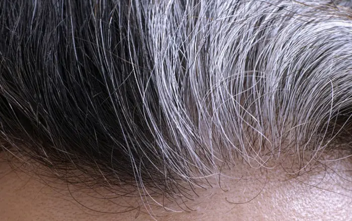 Tóc Bạc: Không Chỉ Là Dấu Hiệu Tuổi Già – Giải Mã Nguyên Nhân & Sự Thật Bất Ngờ Tóc Bạc: Không Chỉ Là Dấu Hiệu Tuổi Già – Giải Mã Nguyên Nhân & Sự Thật Bất Ngờ