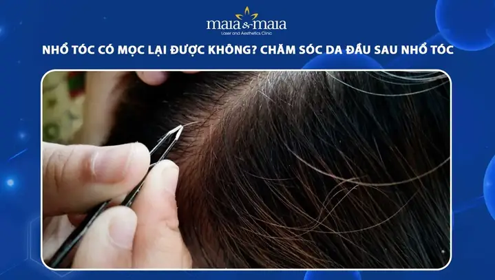 Tóc Bạc Nhổ Đi Có Mọc Lại Không? Giải Đáp Chi Tiết Từ Chuyên Gia